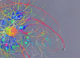 PTW | Online-Vortrag: „Kunsttherapie im Kontext neurologischer und quantischer Vorannahmen.“